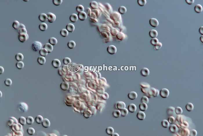 Hématies A et sérum anti-A (agglutination) x160 - gryphea.com